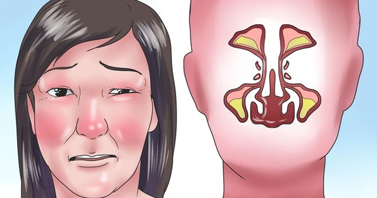 can azelastine cause stuffy nose 