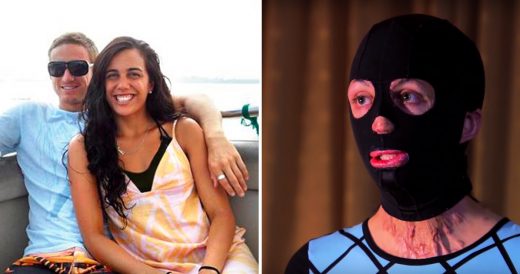 Woman With Severe Burns On Her Body Removes Her Ski Mask After Wearing It For A ...