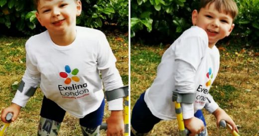 Boy With Amputated Legs Learns How To Walk With Artificial Ones And Raises $600K...