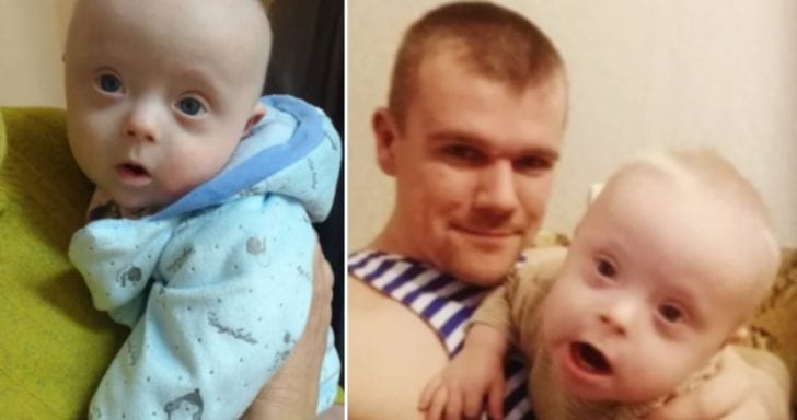 Dad Decides To Raise Son With Down Syndrome Alone