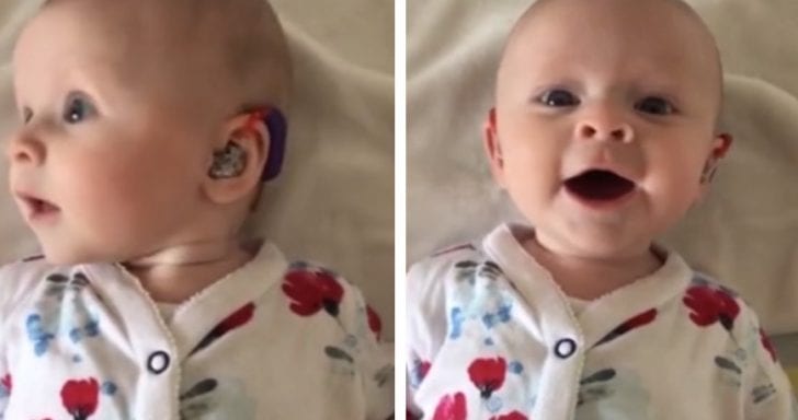 Baby Who Is Deaf Gives A Sweet Smile When Her Hearing Aid Is Switched On