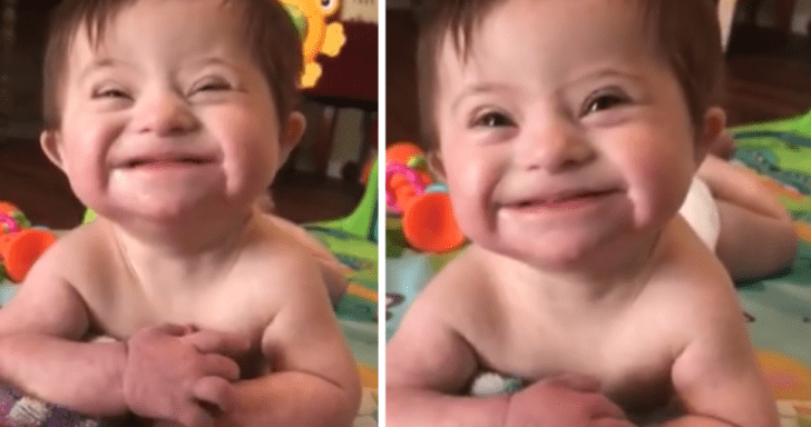 Adopted Baby With Down Syndrome Lights Up The Room With Her Sweet Smile